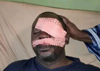 Bomboly : l’œil gauche du journaliste Daouda Bah grièvement atteint lors d’une manifestation
