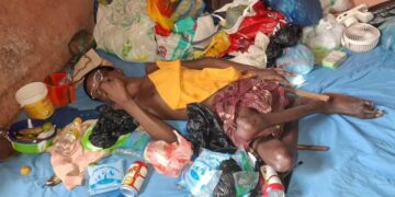 Samatran : Alité depuis 26 ans, Amadou Baïlo Bah lance un cri du cœur